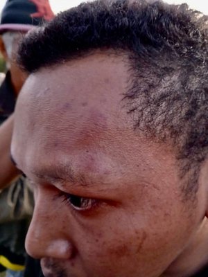 Herry Kabut Verletzungen